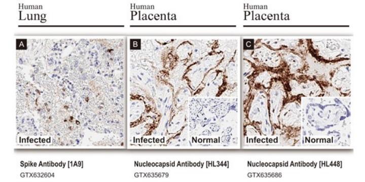 SARS-CoV-2 :Ab Independently Validated 